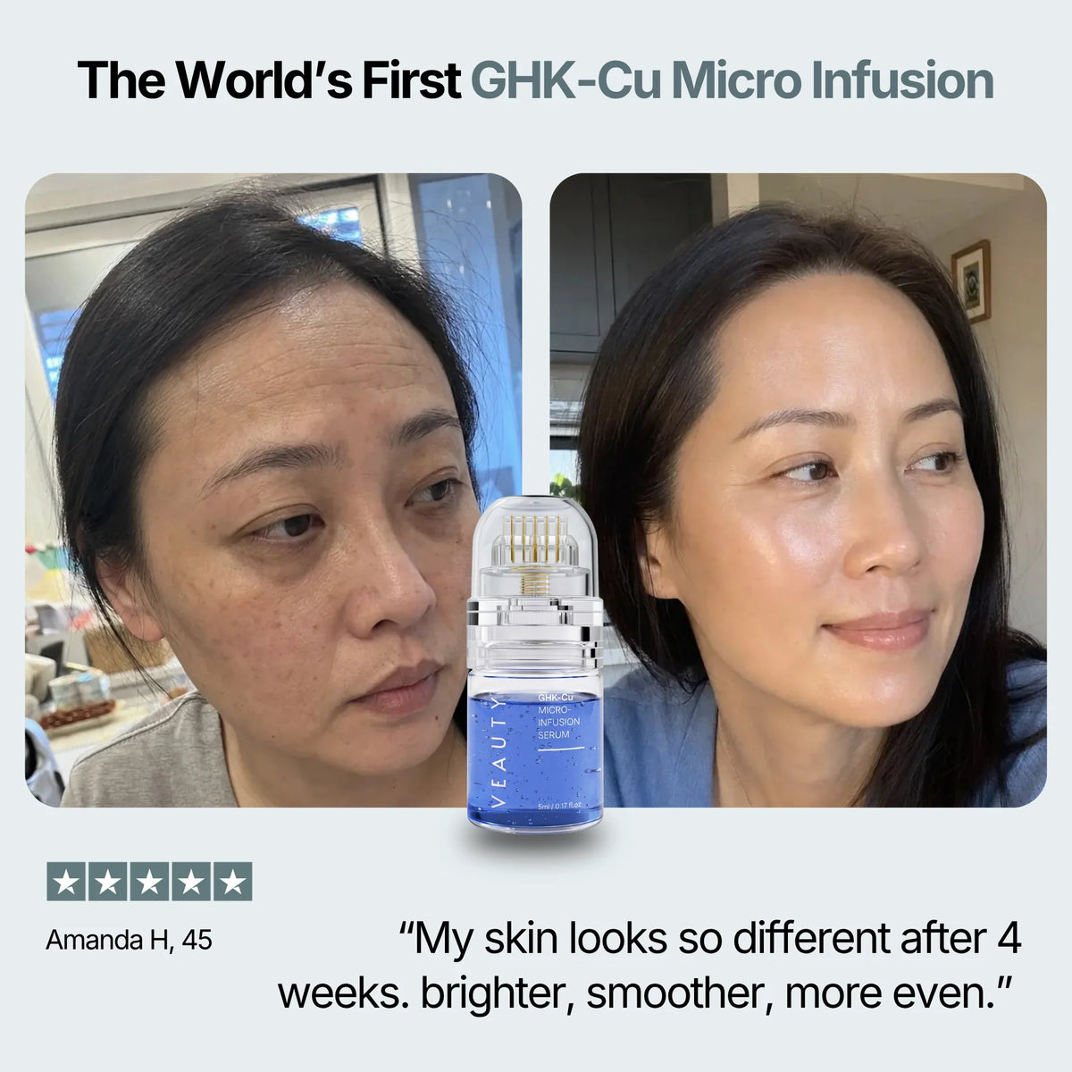 GHK-Cu Micro-Infusion