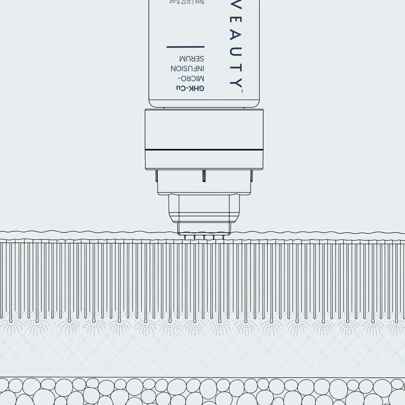 Stamp vertical penetration diagram