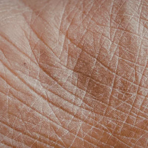 Fine Lines