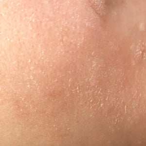 Dull Skin