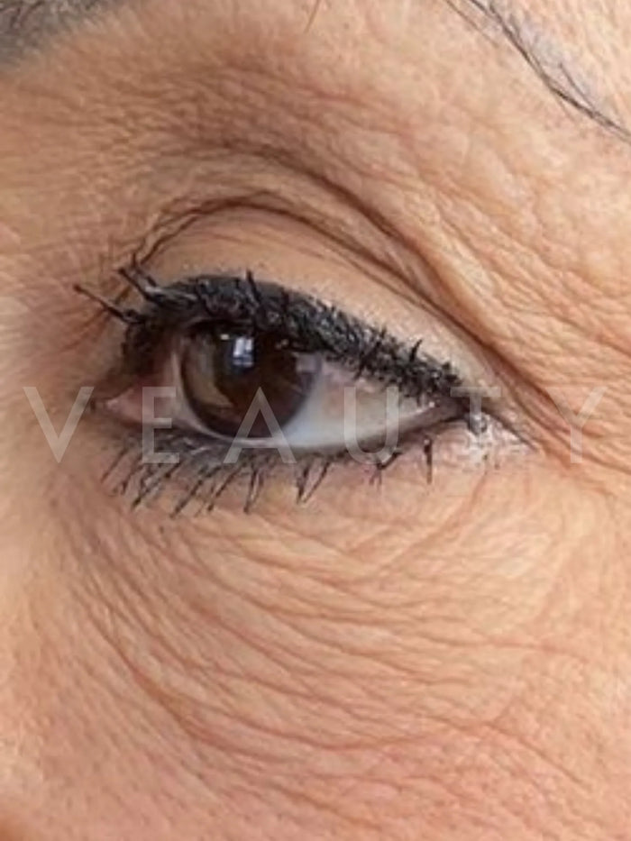 Susan, 55 · 12 weeks