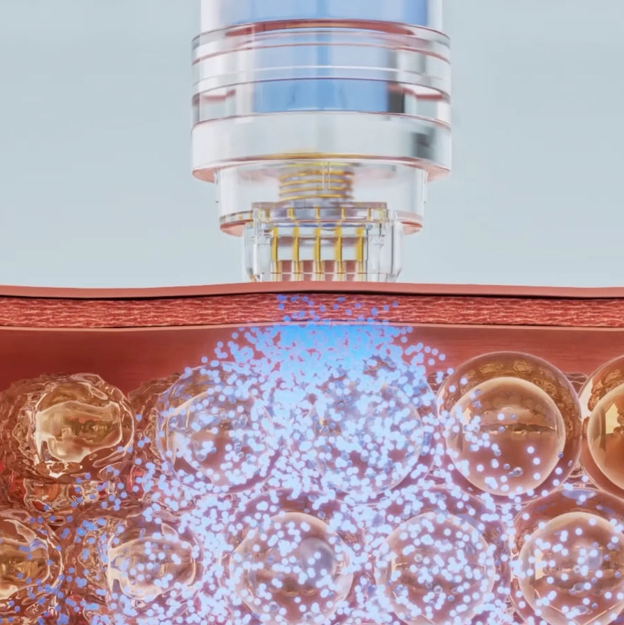 Illustration of GHK-Cu serum being delivered through micro-channels into the dermis