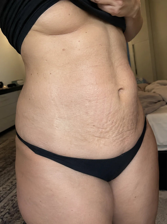 Nicole, 35 · 16 weeks